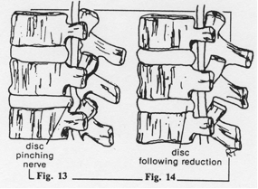 Fig13_14